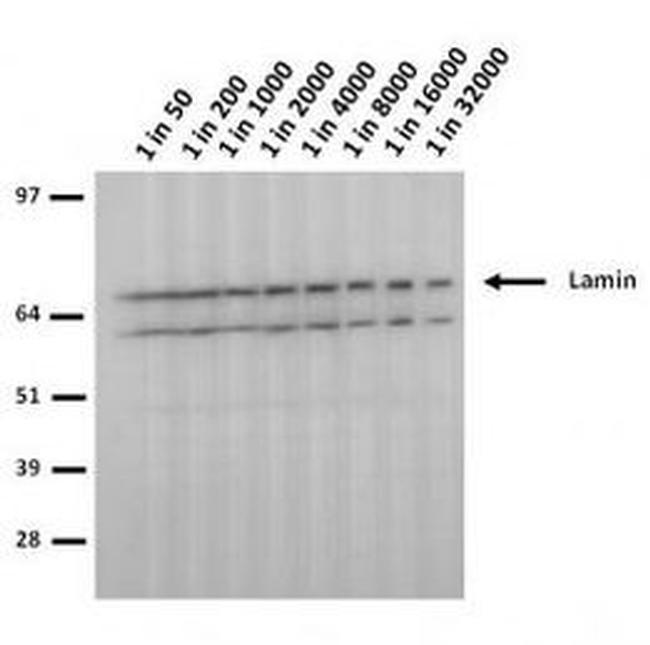 Lamin A/C (R482W) Antibody in Western Blot (WB)