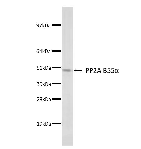 PP2A B-alpha Antibody in Western Blot (WB)