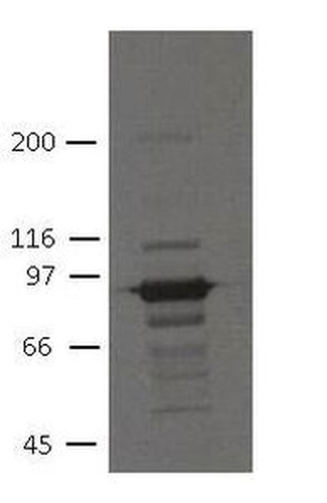 PKP3 Antibody in Western Blot (WB)