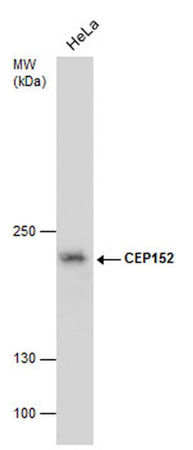 CEP152 Antibody in Western Blot (WB)