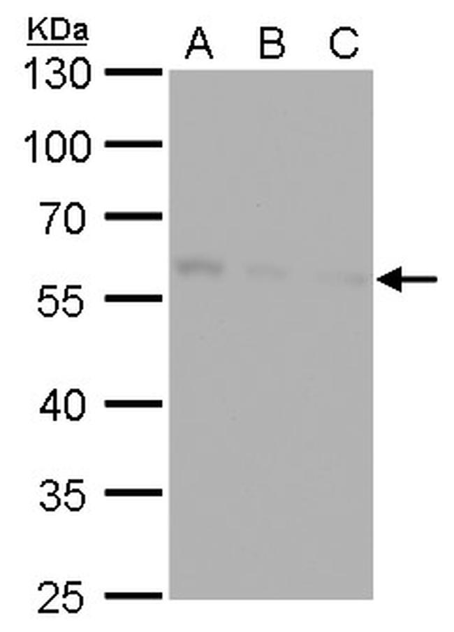 CALCOCO2 Antibody in Western Blot (WB)