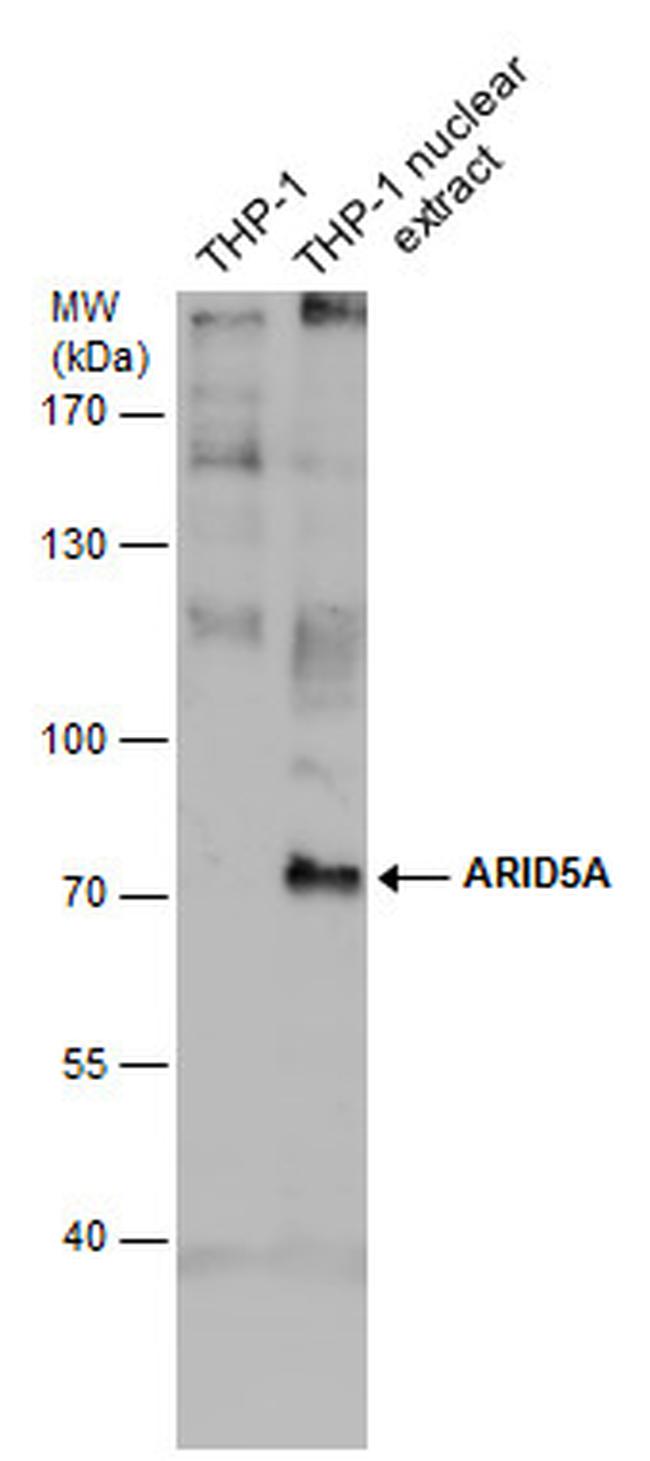 ARID5A Antibody in Western Blot (WB)