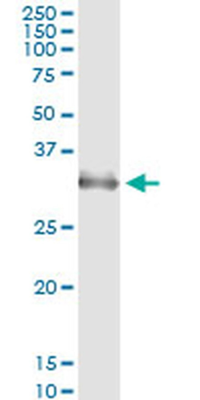 HOXA1/HOXB1/HOXD1 Antibody in Immunoprecipitation (IP)