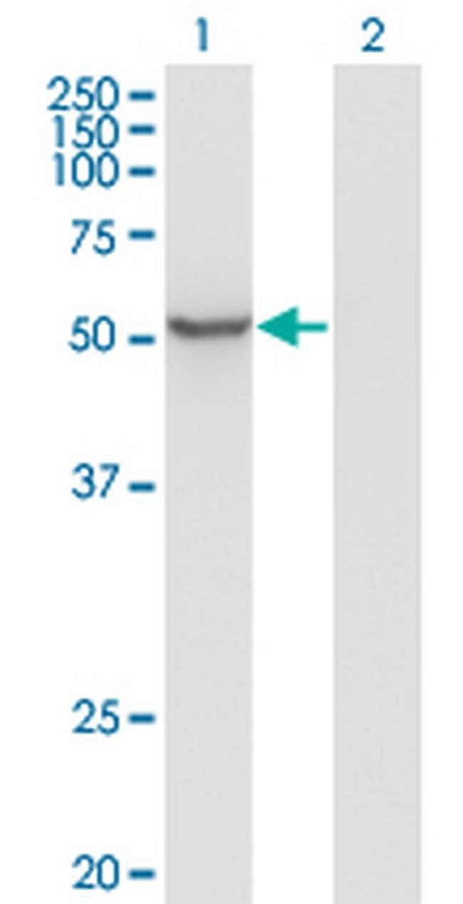 ZNF70 Antibody in Western Blot (WB)