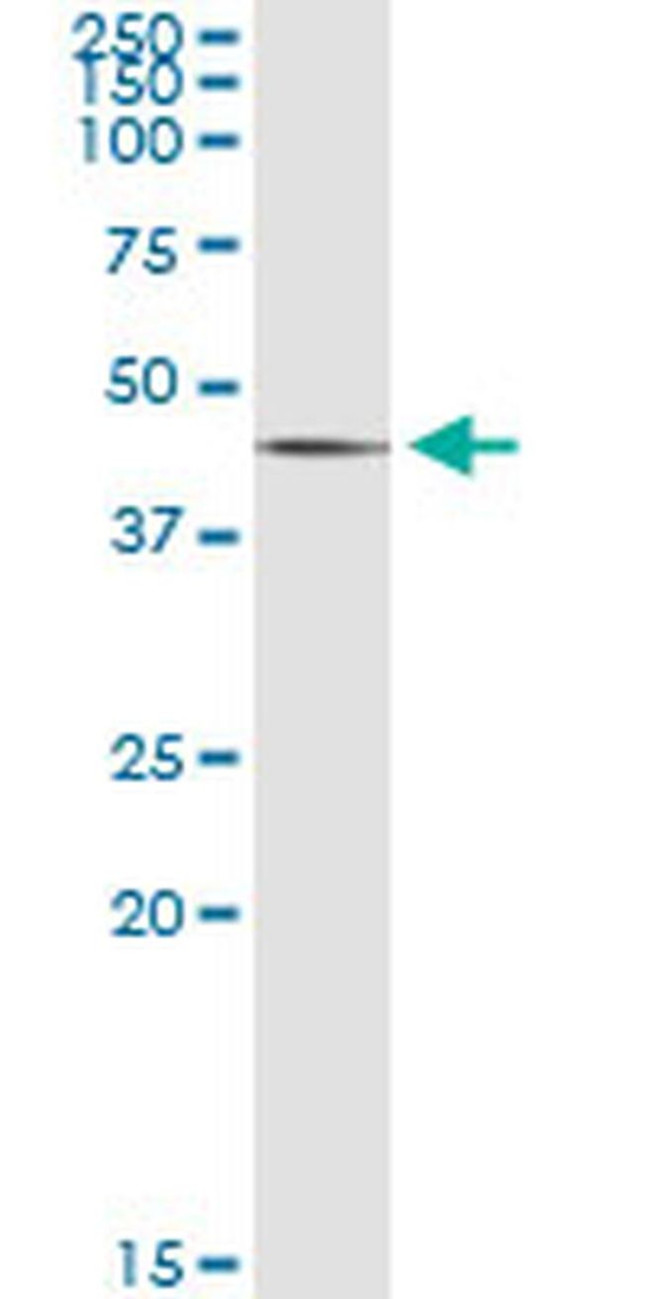 SGK2 Antibody in Immunoprecipitation (IP)