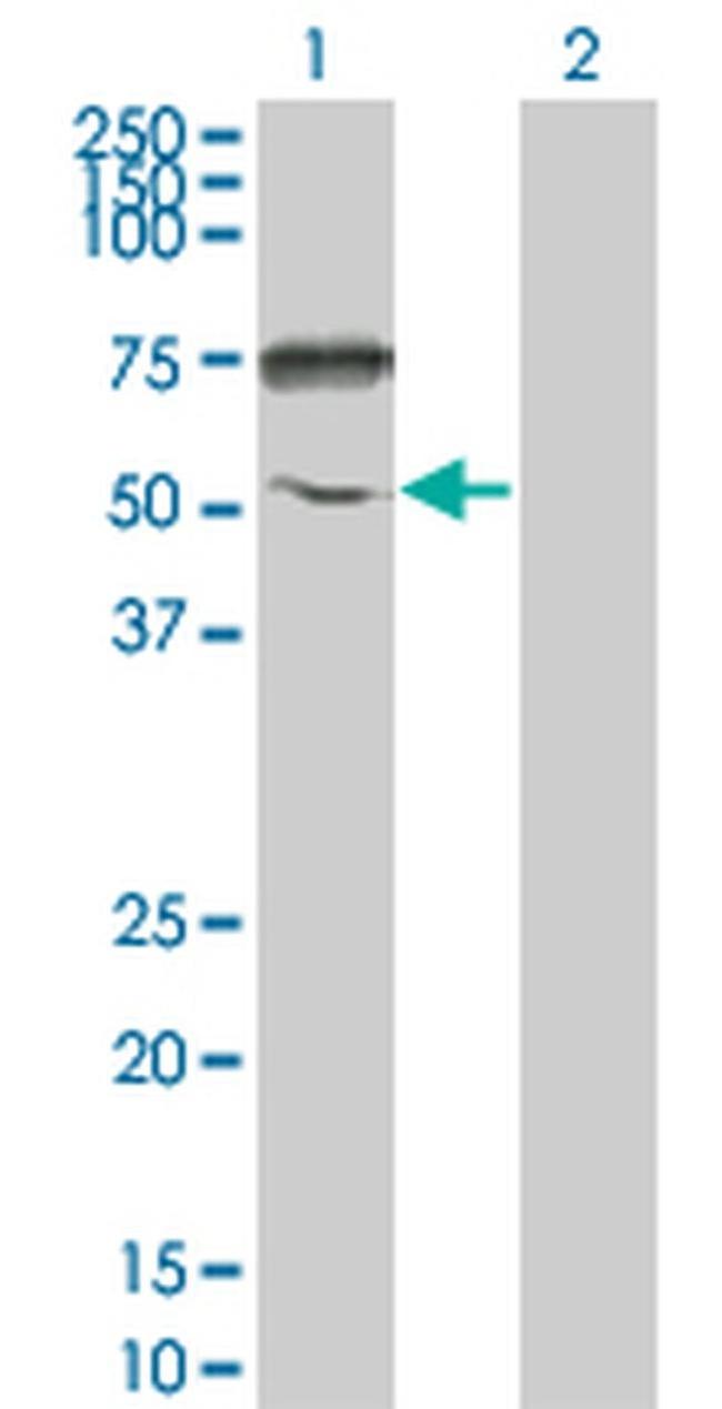 ENPP5 Antibody in Western Blot (WB)