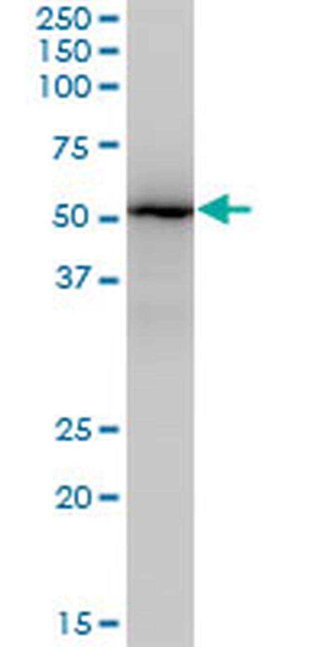 ZNF447 Antibody in Western Blot (WB)