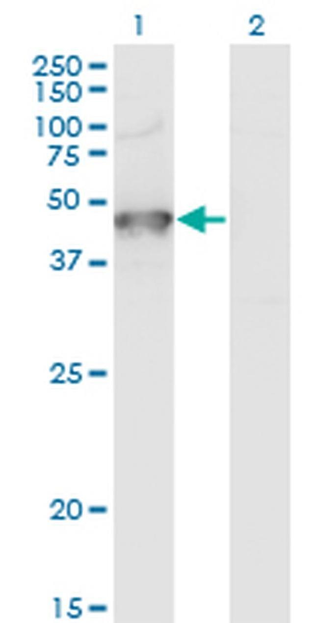 GRINL1A Antibody in Western Blot (WB)