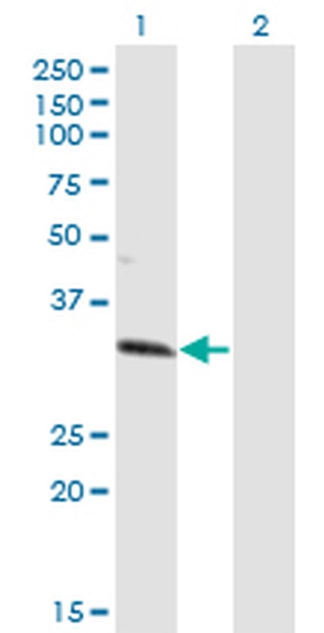 ZNF101 Antibody in Western Blot (WB)