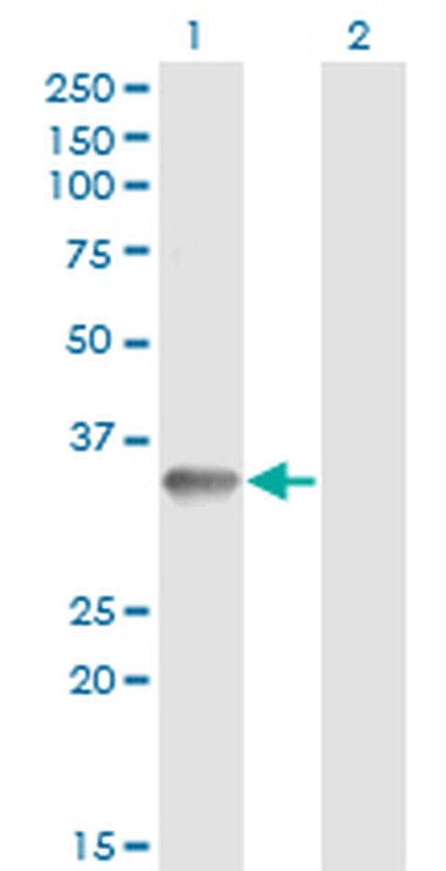 RNF212 Antibody in Western Blot (WB)