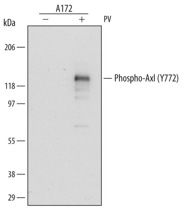 Phospho-Axl (Tyr779) Antibody in Western Blot (WB)