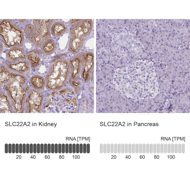 SLC22A2 Antibody in Immunohistochemistry (IHC)