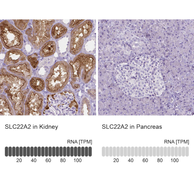 SLC22A2 Antibody in Immunohistochemistry (IHC)