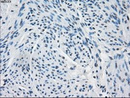 Fumarase Antibody in Immunohistochemistry (Paraffin) (IHC (P))