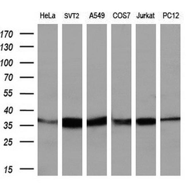 IDH3A Antibody in Western Blot (WB)