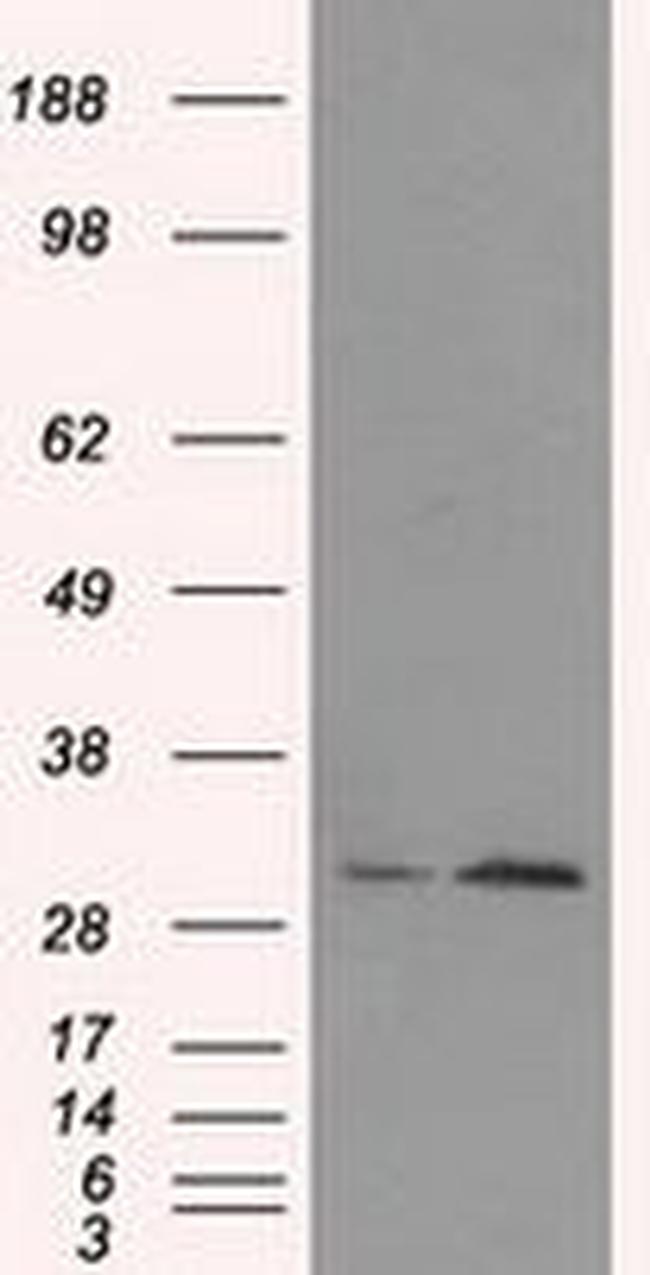 TIPRL Antibody in Western Blot (WB)