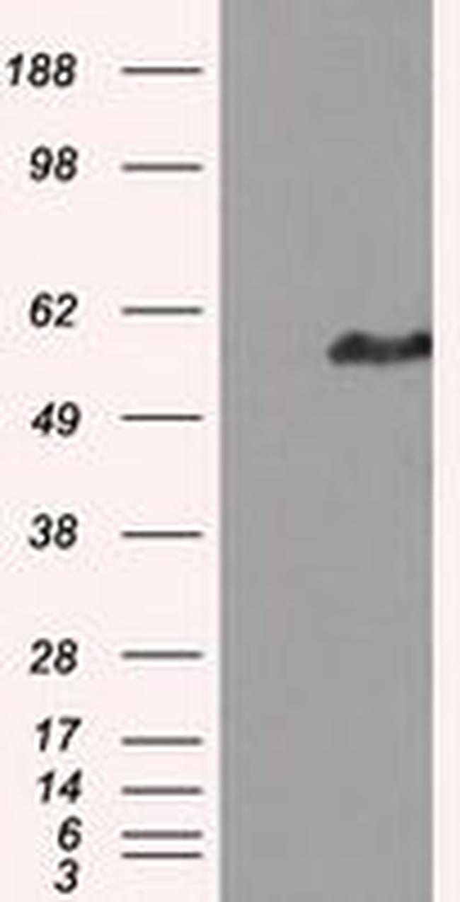 HIPPI Antibody in Western Blot (WB)