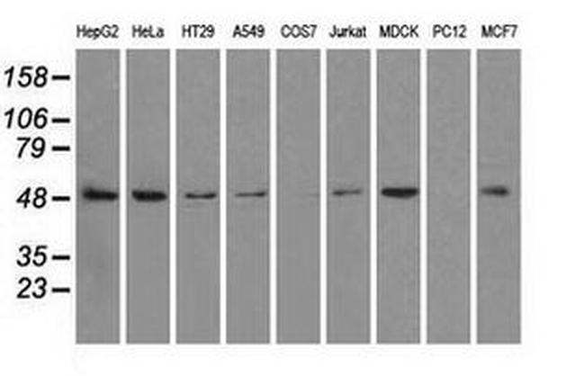 PSMC3 Antibody in Western Blot (WB)