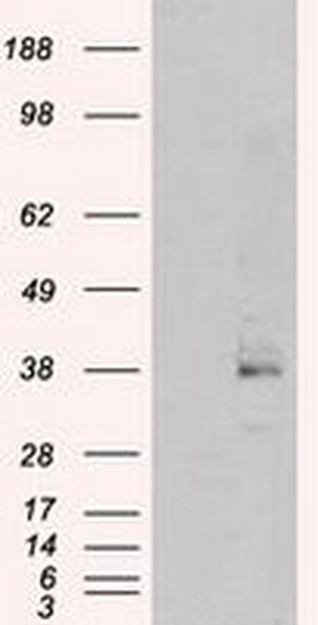 Serine racemase Antibody in Western Blot (WB)