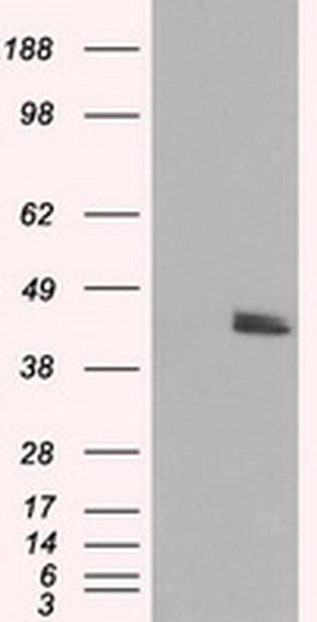 RF1ML Antibody in Western Blot (WB)