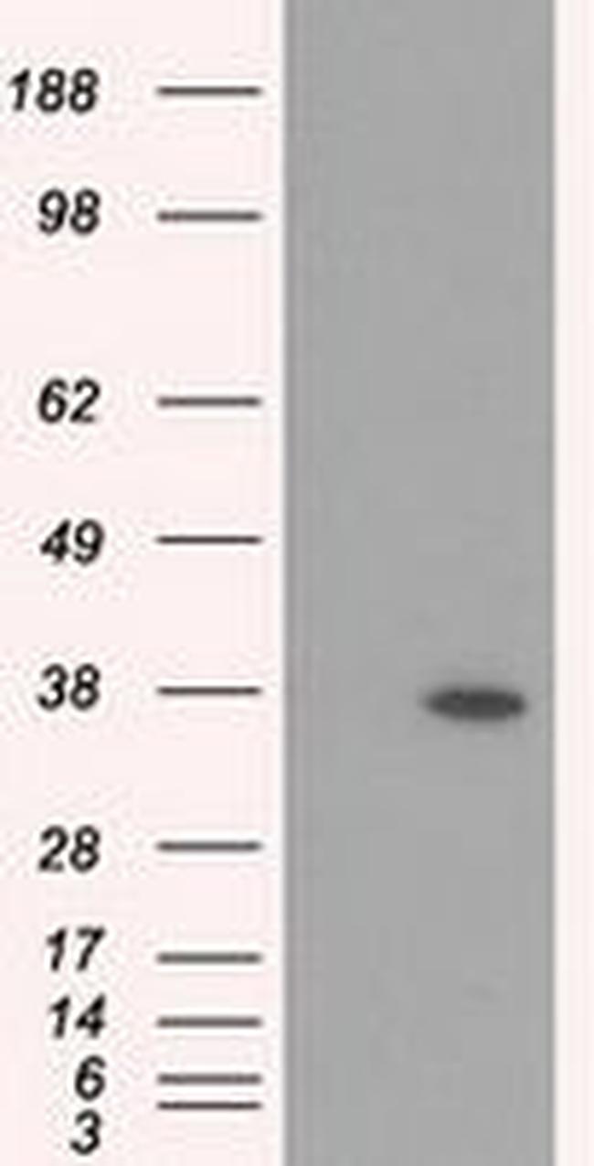 RDH11 Antibody in Western Blot (WB)