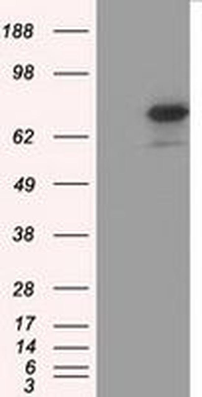 H6PD Antibody in Western Blot (WB)