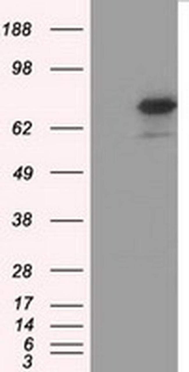 BMAL1 Antibody in Western Blot (WB)