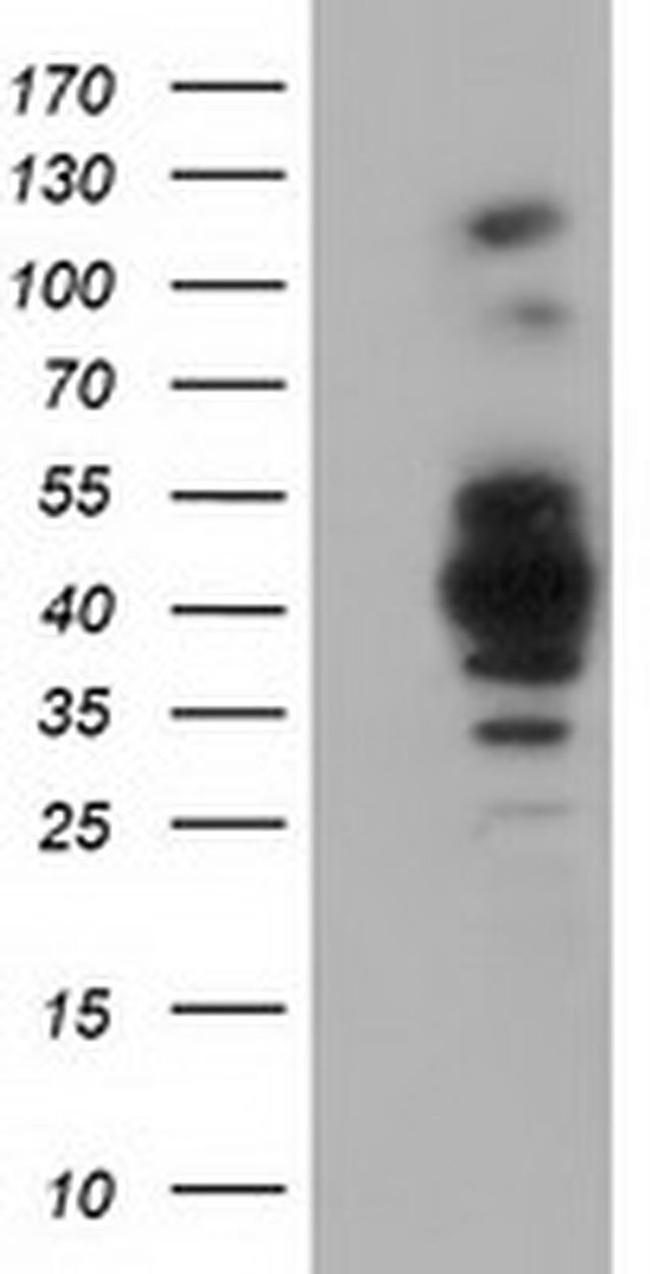 GAS7 Antibody in Western Blot (WB)
