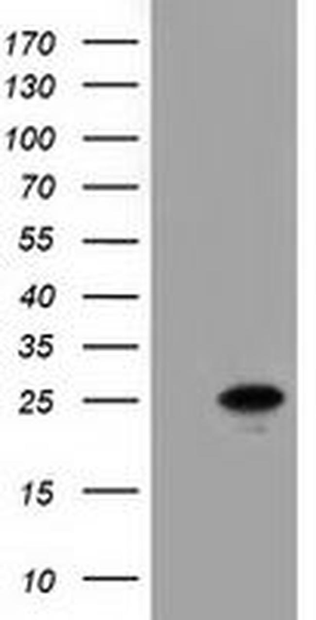 Adenylate Kinase 3 Antibody in Western Blot (WB)
