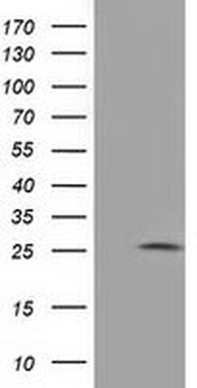 Adenylate Kinase 3 Antibody in Western Blot (WB)