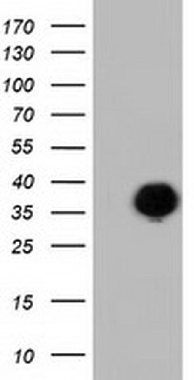 FAM84B Antibody in Western Blot (WB)
