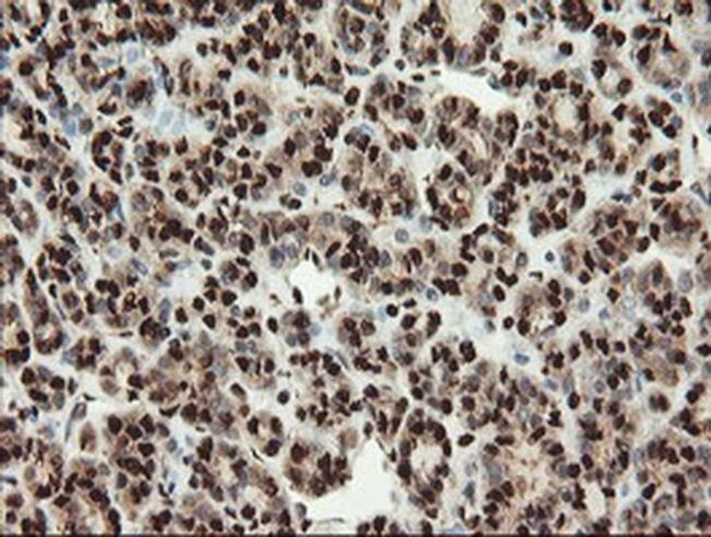 SAMHD1 Antibody in Immunohistochemistry (Paraffin) (IHC (P))