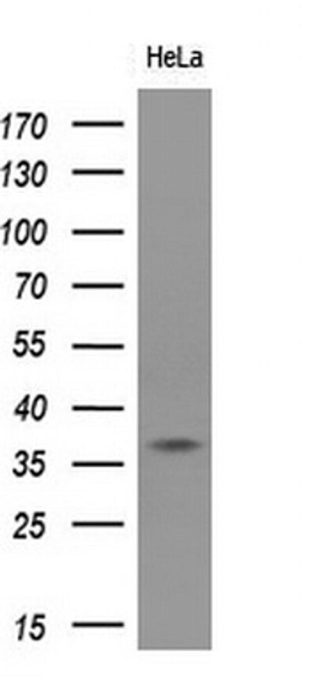 HSP40 Antibody in Western Blot (WB)
