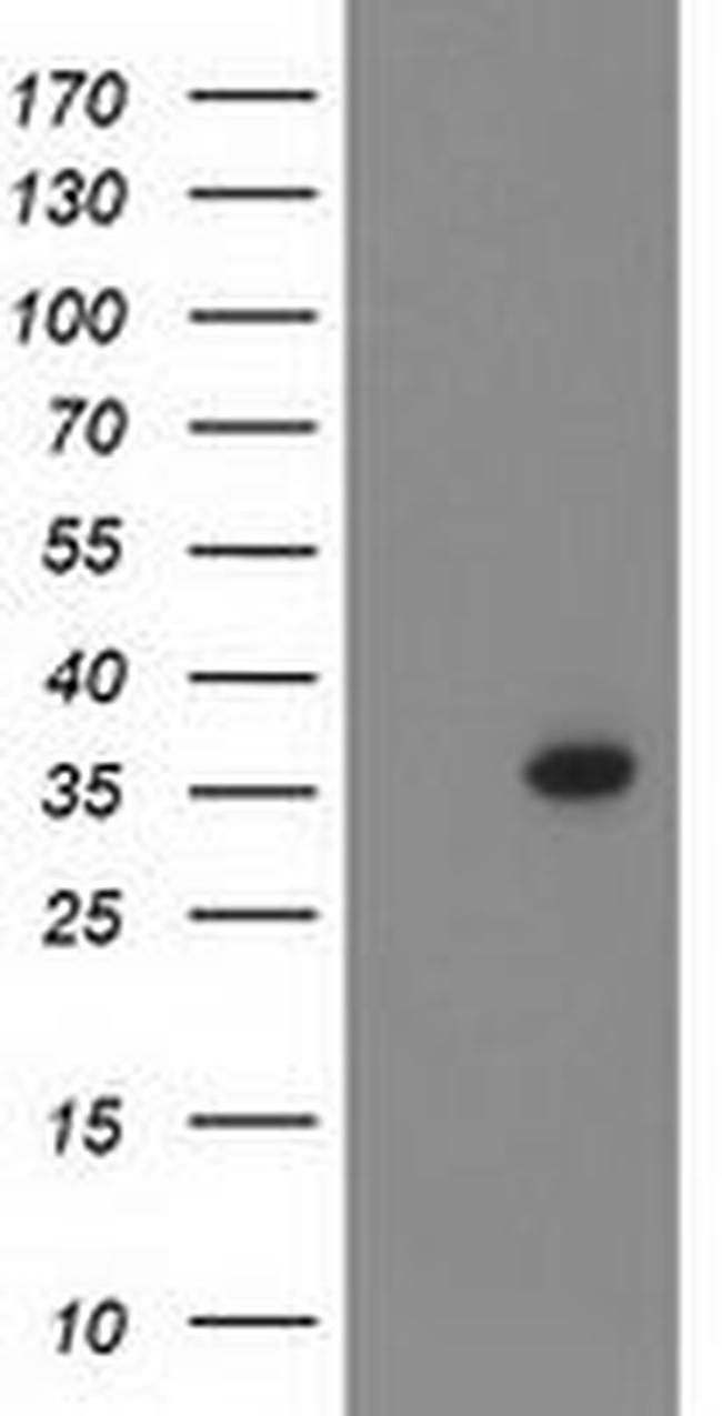 PIH1D2 Antibody in Western Blot (WB)