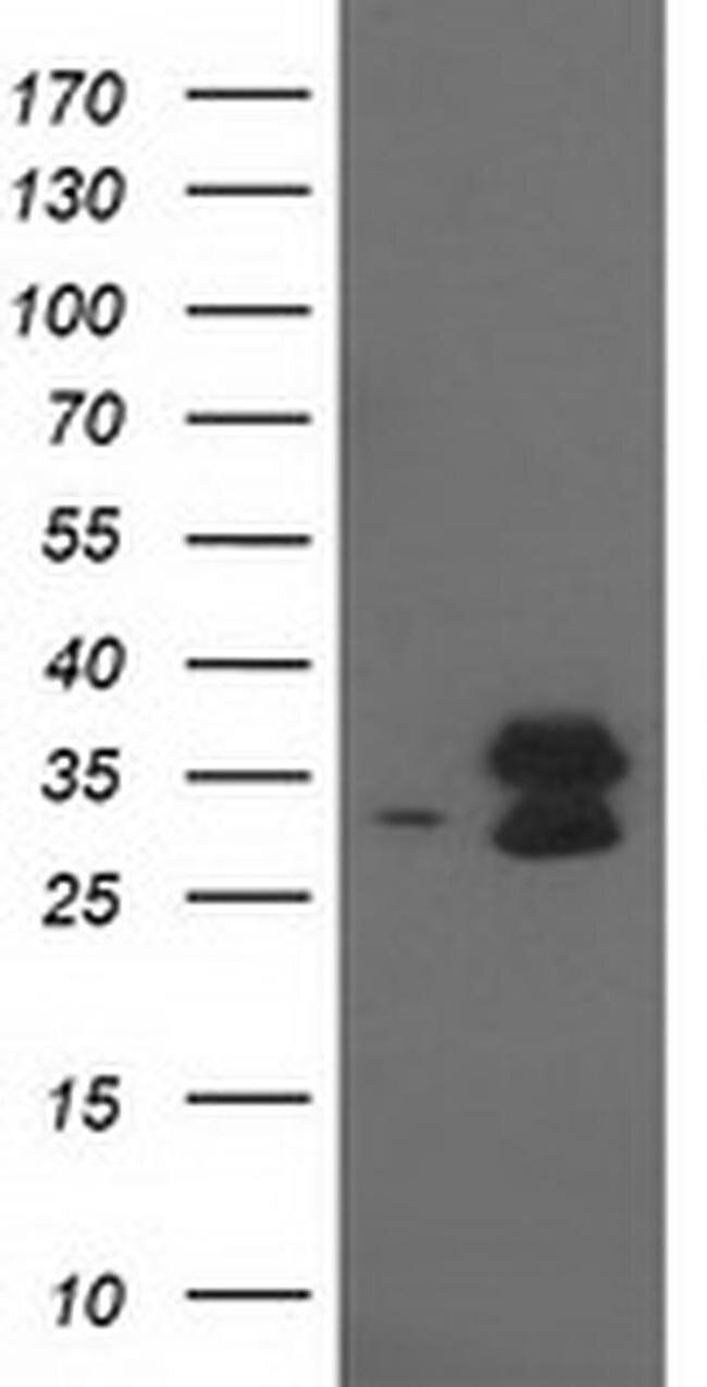 eIF4E2 Antibody in Western Blot (WB)