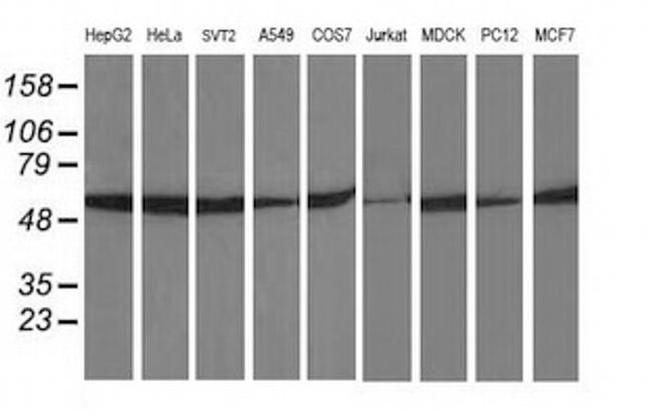 beta-4 Tubulin Antibody in Western Blot (WB)