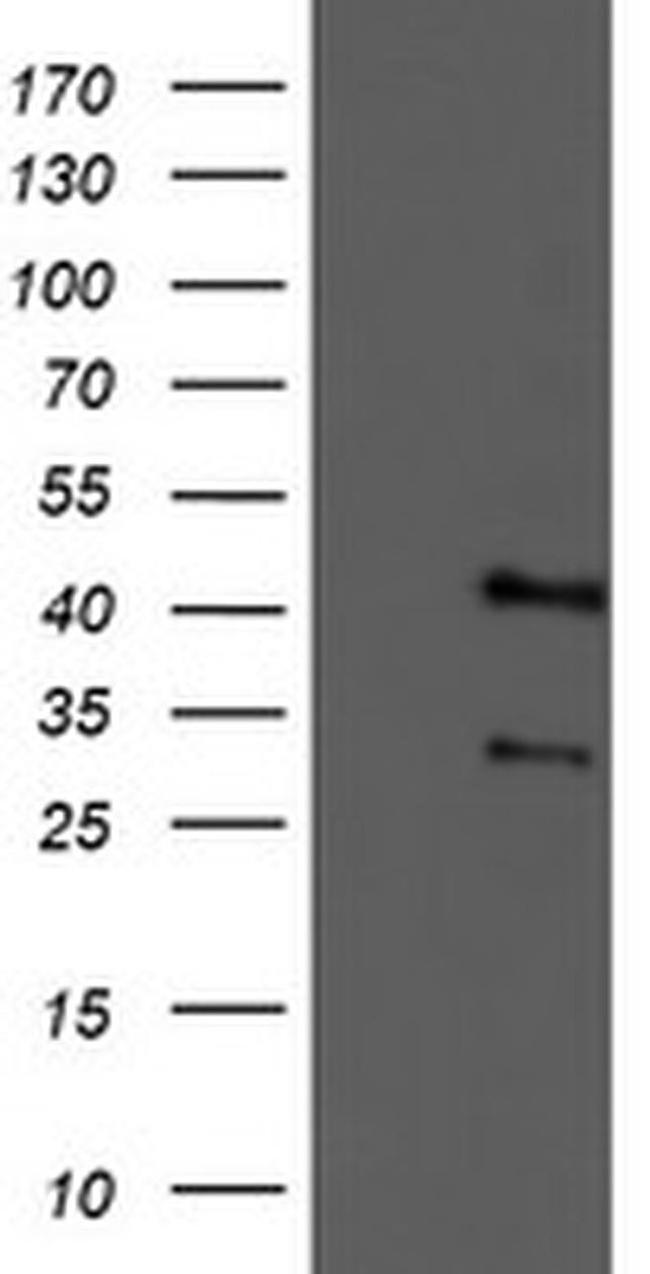 TMOD1 Antibody in Western Blot (WB)