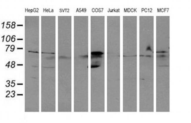 ALDH3A2 Antibody in Western Blot (WB)