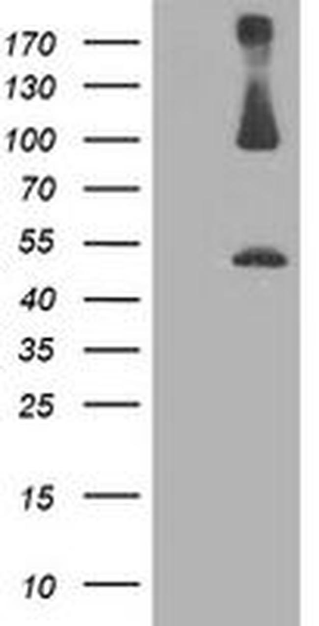 PSMD2 Antibody in Western Blot (WB)