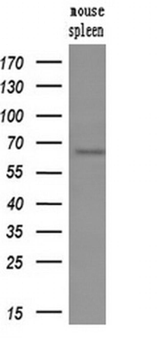 GBP1 Antibody in Western Blot (WB)