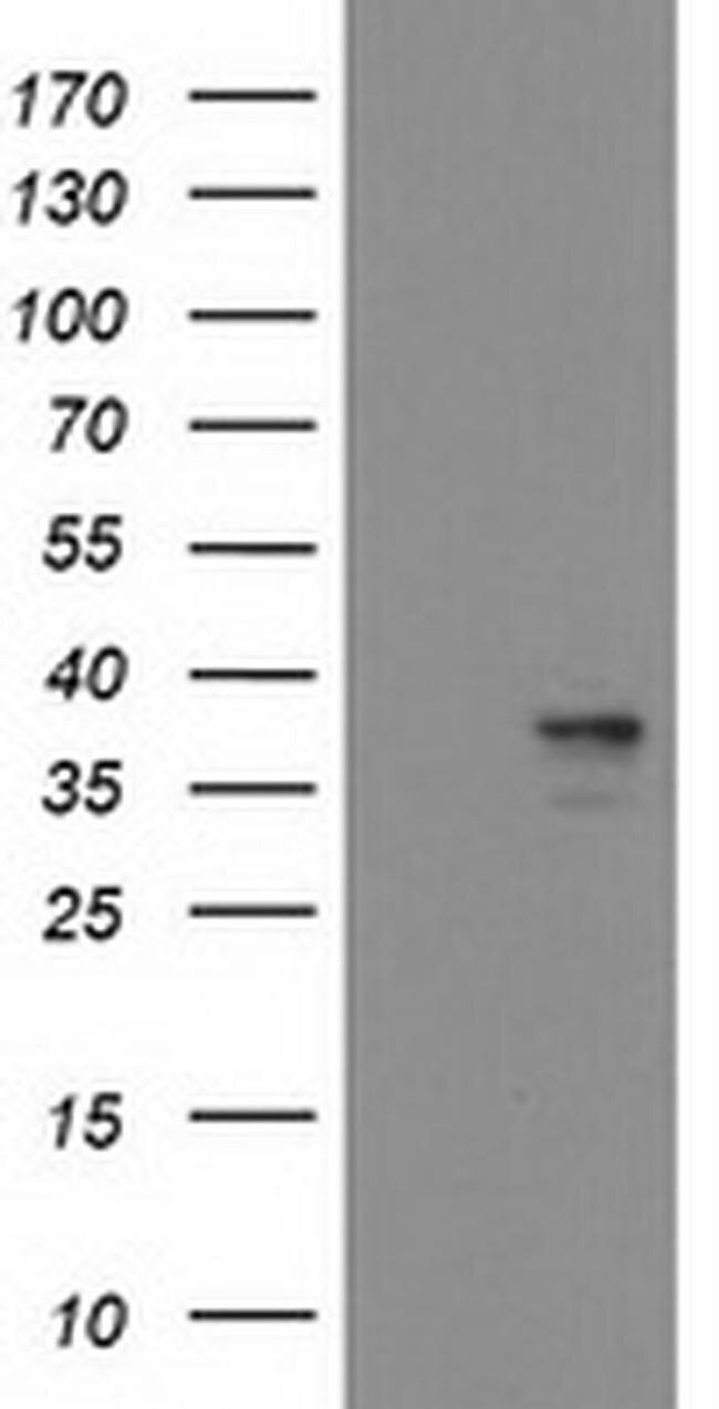 Heme oxygenase 2 Antibody in Western Blot (WB)
