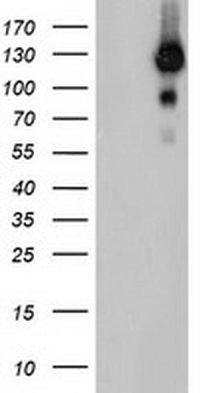 USP10 Antibody in Western Blot (WB)