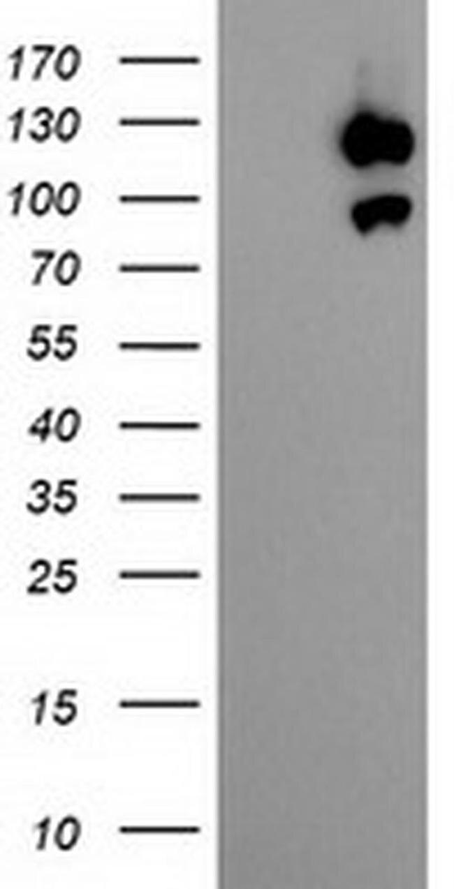 USP10 Antibody in Western Blot (WB)