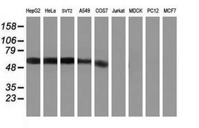 Kir3.1 (KCNJ3) Antibody in Western Blot (WB)