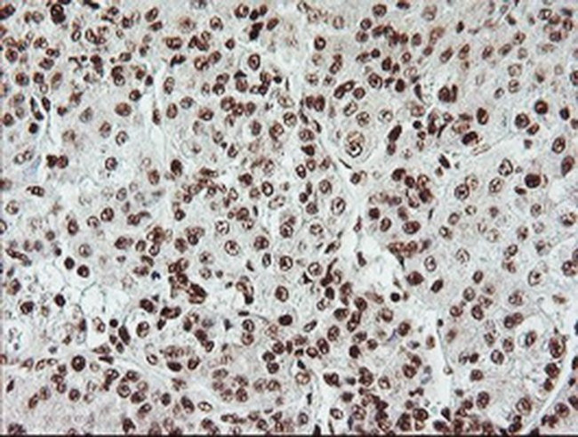 EXOSC7 Antibody in Immunohistochemistry (Paraffin) (IHC (P))