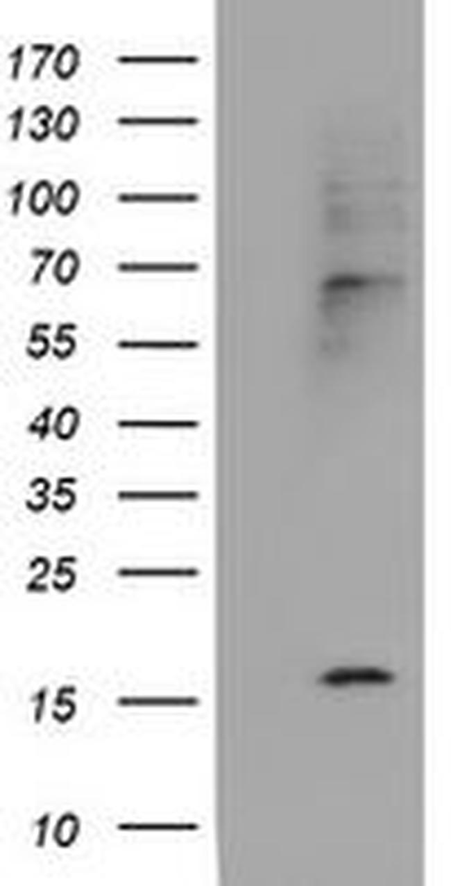 Cystatin 2 Antibody in Western Blot (WB)