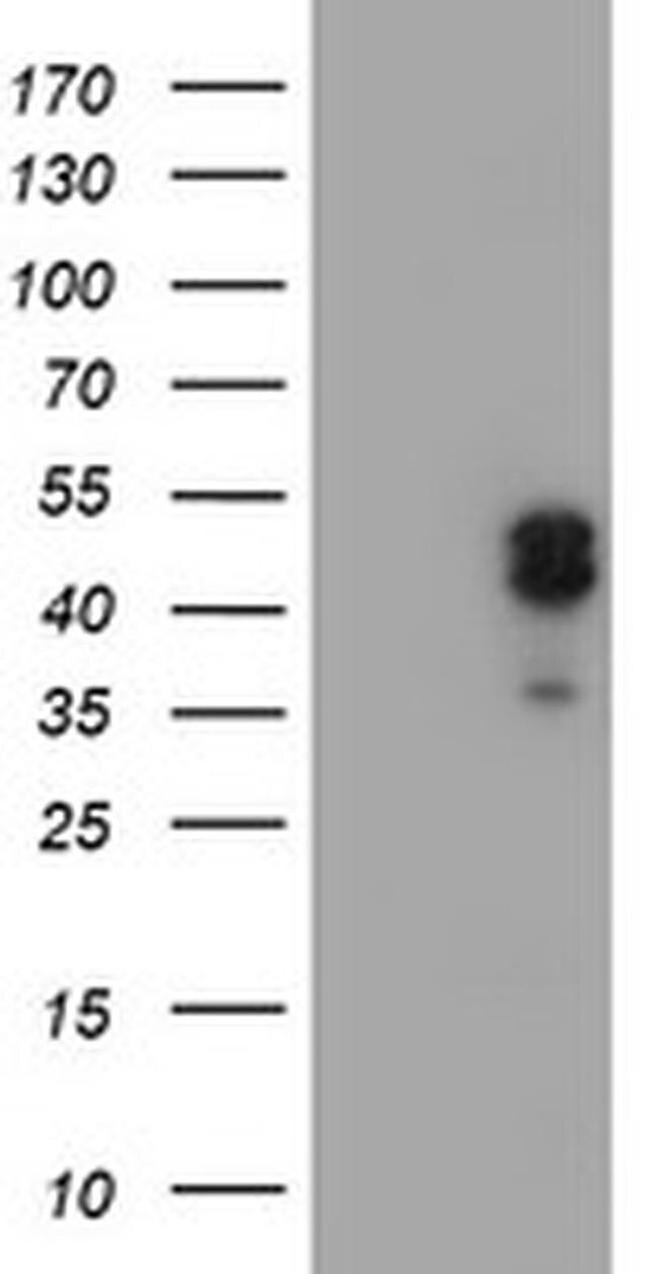 LIM1 Antibody in Western Blot (WB)
