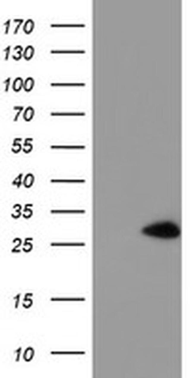 NANP Antibody in Western Blot (WB)