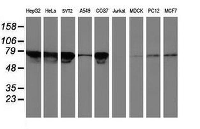 TFR2 Antibody in Western Blot (WB)