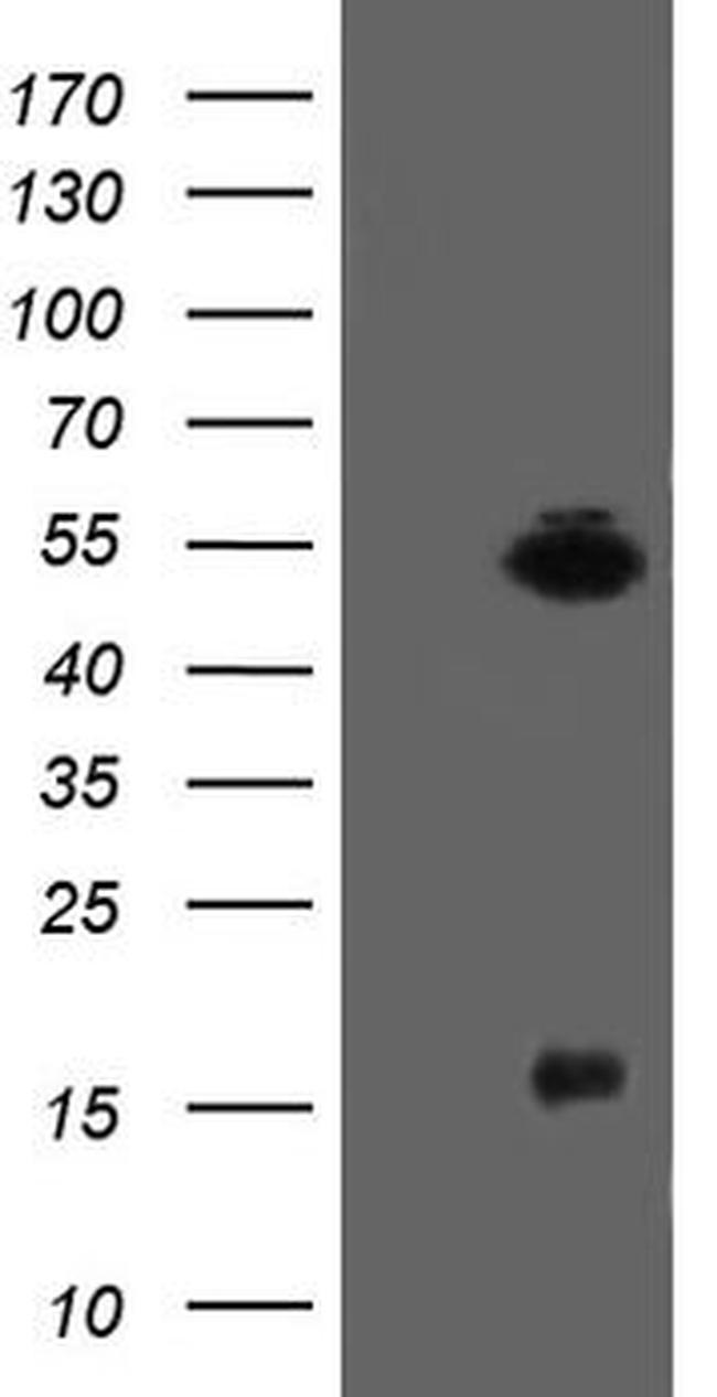 ALX4 Antibody in Western Blot (WB)